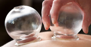 Massage cupping therapy